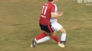 肿胀明显！博主晒三镇球员王毅脚踝被踩踏赛后情况